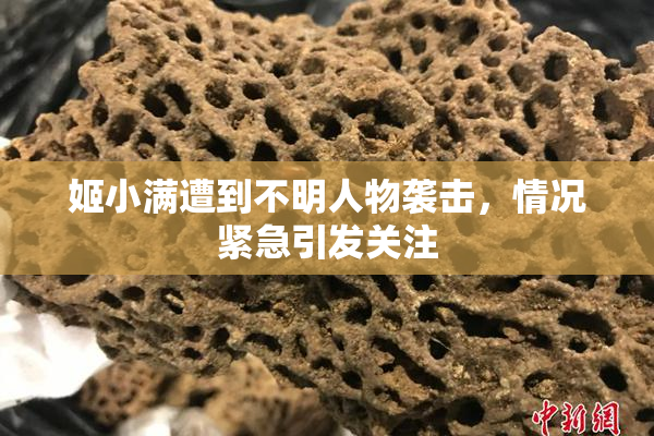 姬小满遭到不明人物袭击，情况紧急引发关注