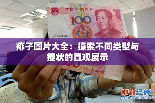 痱子图片大全：探索不同类型与症状的直观展示