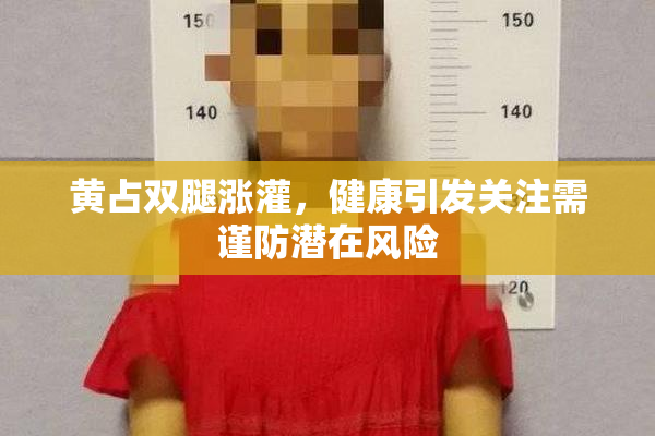 黄占双腿涨灌，健康引发关注需谨防潜在风险