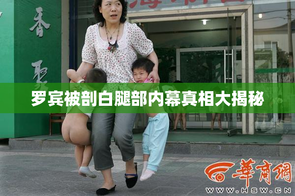 罗宾被剖白腿部内幕真相大揭秘