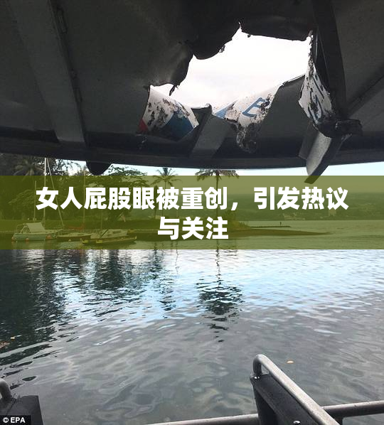 女人屁股眼被重创，引发热议与关注