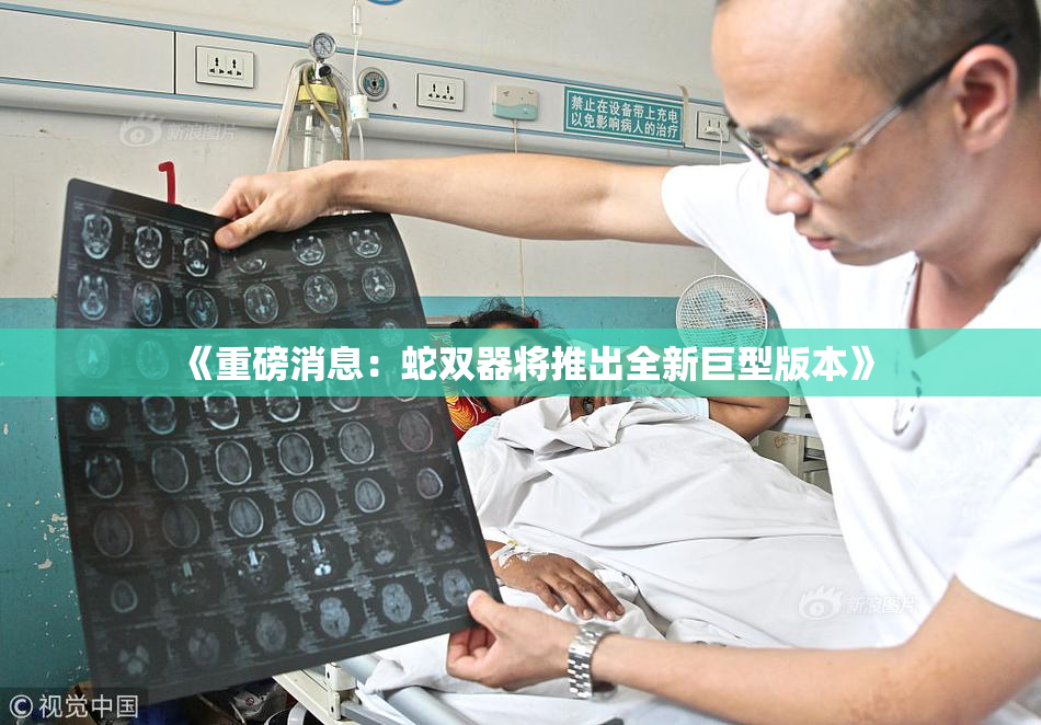 《重磅消息：蛇双器将推出全新巨型版本》