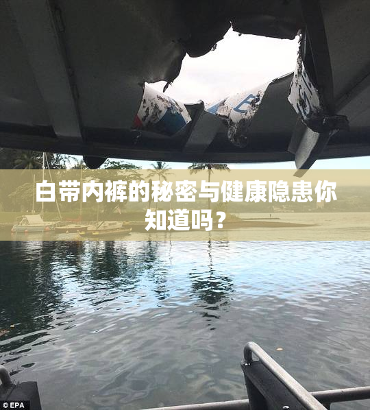 白带内裤的秘密与健康隐患你知道吗？