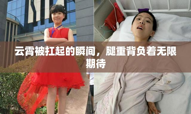 云霄被扛起的瞬间，腿重背负着无限期待