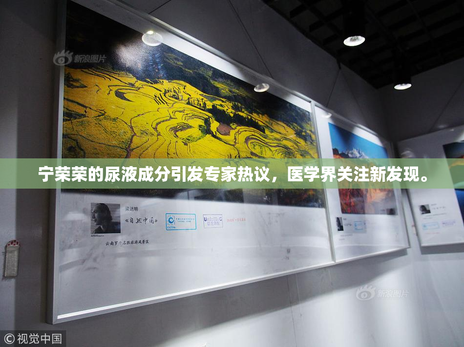 宁荣荣的尿液成分引发专家热议，医学界关注新发现。