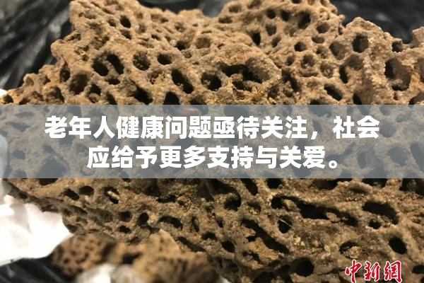 老年人健康问题亟待关注，社会应给予更多支持与关爱。